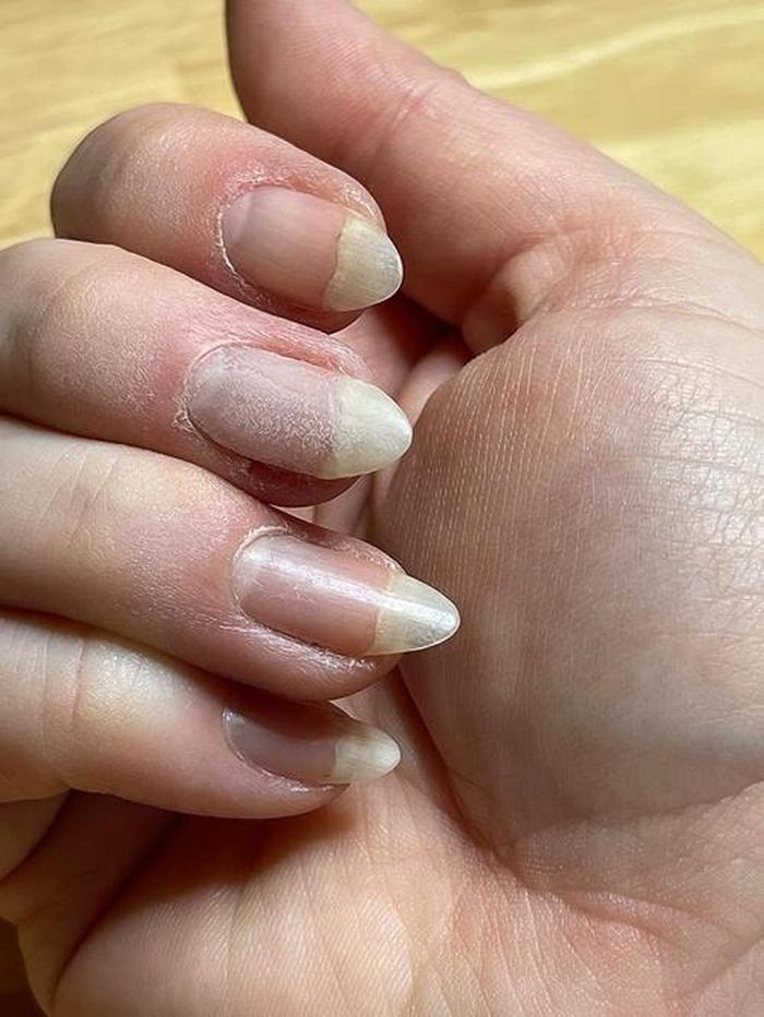 Cracked Nail Repair Gel Strengthen Long Lasting Harmless For Uv Acrylic Broken Nails Gel photo review