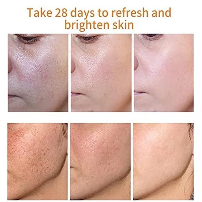 Freckle Cream Moisturizing Anti-Aging Remove Dark Spots