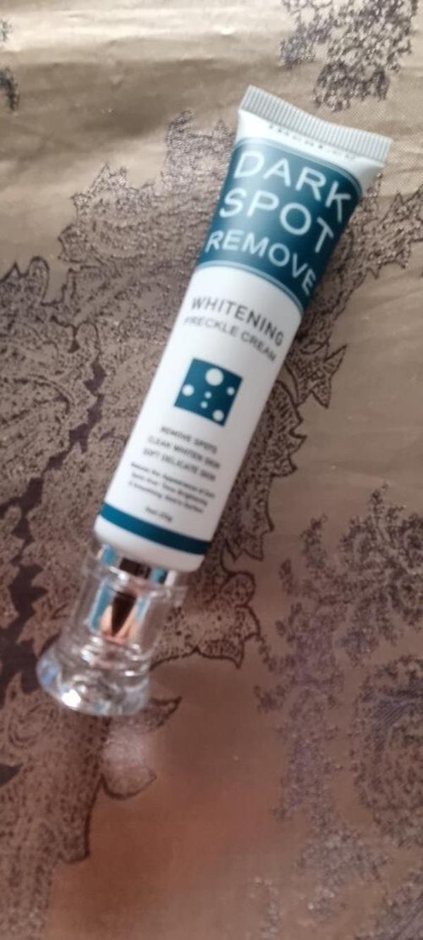 Freckle Cream Moisturizing Anti-Aging Remove Dark Spots photo review