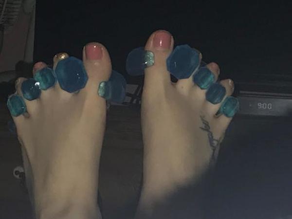 Gel Toe Stretcher & Separator photo review