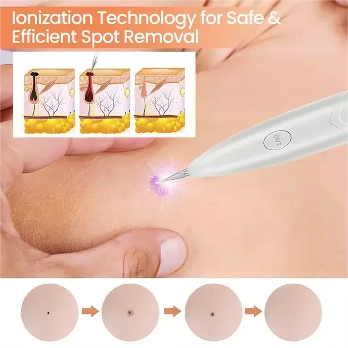 Ion Laser Freckle Skin Mole Dark Spot Remover Face Wart Tag Tattoo Removal Pen