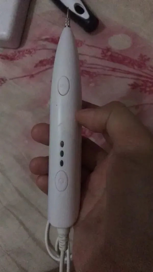 Ion Laser Freckle Skin Mole Dark Spot Remover Face Wart Tag Tattoo Removal Pen photo review