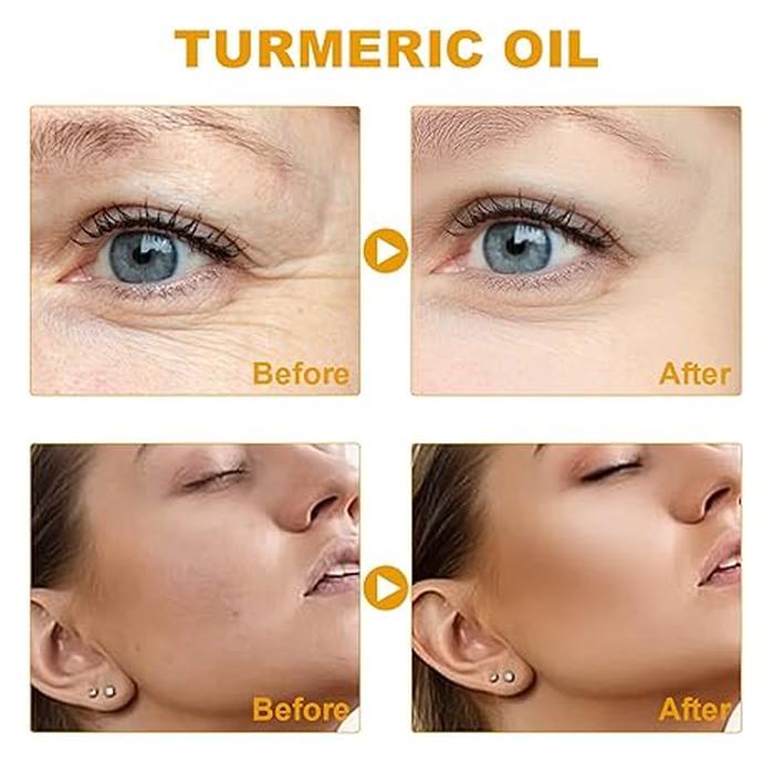 Turmeric Dark Spot Corrector Serum